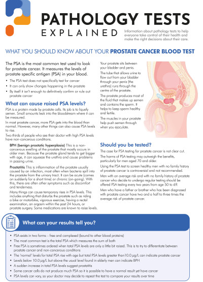 Prostate cancer blood test