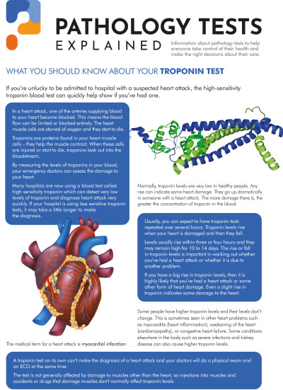 Troponin